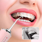 OralPure-Irrigador Bucal Portátil Limpeza Profunda com Jato d’Água