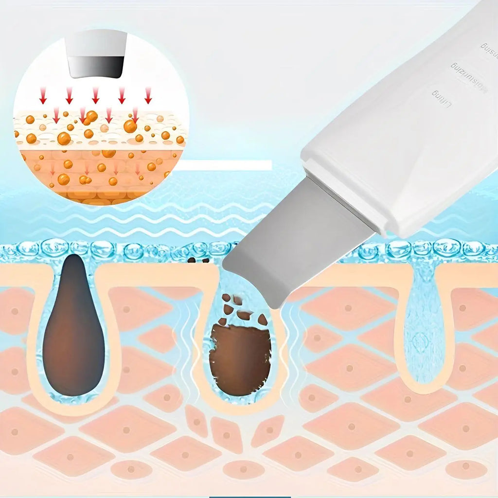 LumiCare-Peeling Esfoliante Ultrassônico Facial