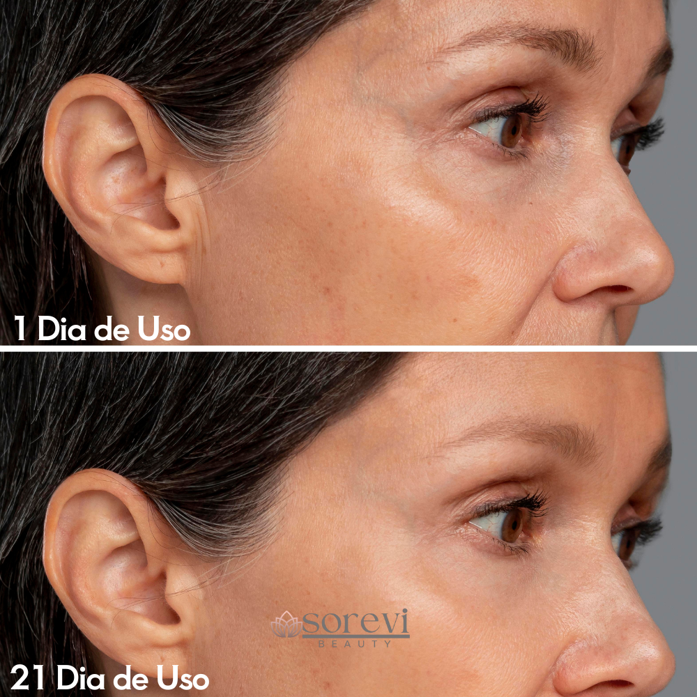 DermaGlow-Massageador Facial Rejuvenescedor  Anti-Rugas