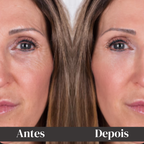 Face Booster Pro™: Dispositivo Coreano Rejuvenescedor Facial