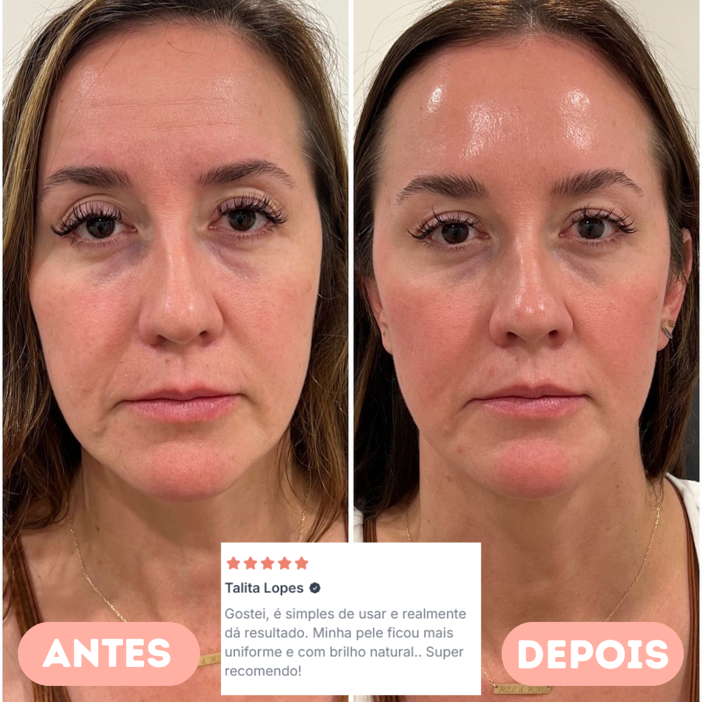 LumiThera-Máscara LED Facial 7 Cores – Fototerapia Profissional para Acne, Manchas, Anti-idade e Skincare